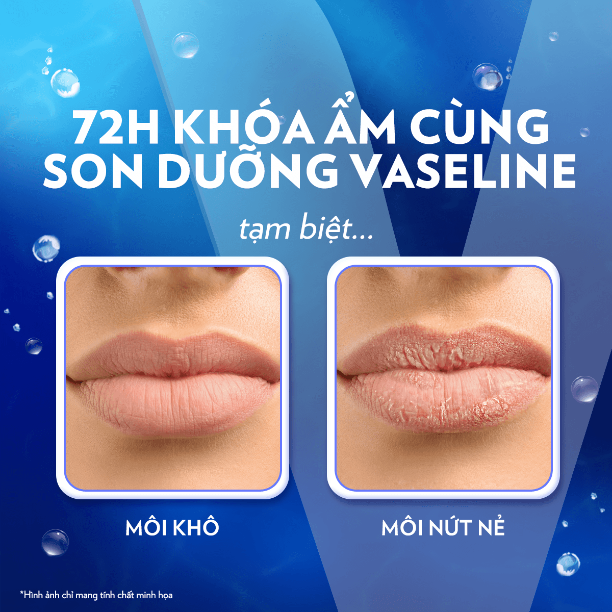 sap-duong-moi-vaseline-lips-therapy-original-khong-mau-7gr