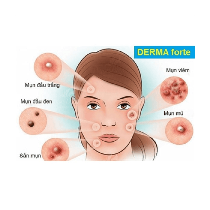 gel-duong-ho-tro-giam-mun-va-mo-tham-derma-forte-anti-acne-skin-care-15g